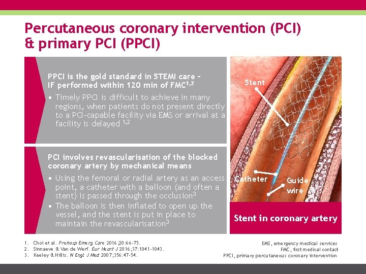 Percutaneous coronary intervention (PCI) & primary PCI (PPCI) PPCI is the gold standard in