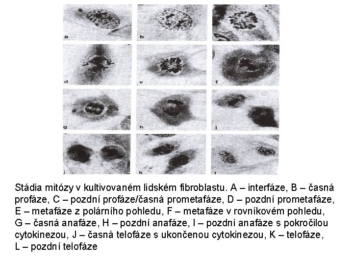 Stádia mitózy v kultivovaném lidském fibroblastu. A – interfáze, B – časná profáze, C