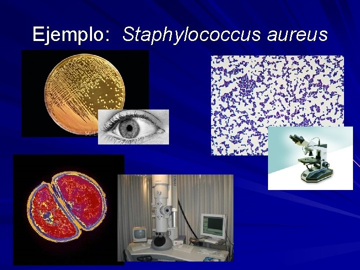 Ejemplo: Staphylococcus aureus Ejemplo: Staphylococcus aureus