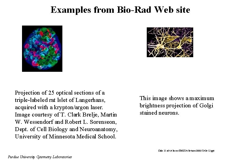 Examples from Bio-Rad Web site Projection of 25 optical sections of a triple-labeled rat