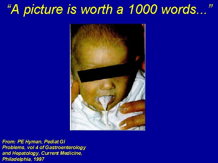 “A picture is worth a 1000 words. . . ” From: PE Hyman, Pediat