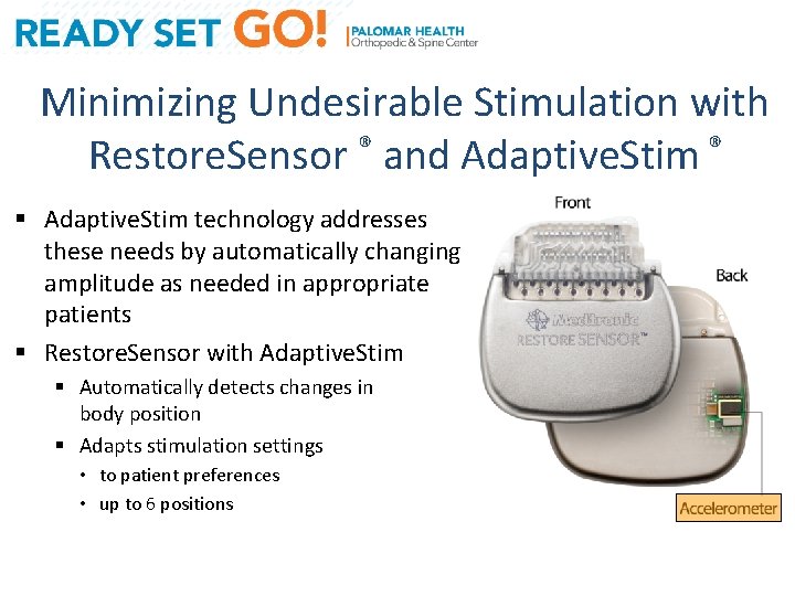 Minimizing Undesirable Stimulation with Restore. Sensor ® and Adaptive. Stim ® § Adaptive. Stim