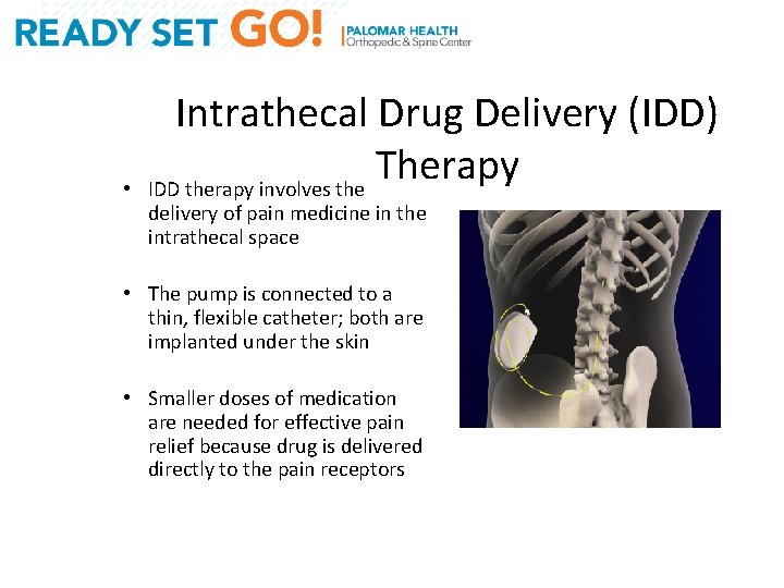  • Intrathecal Drug Delivery (IDD) Therapy IDD therapy involves the delivery of pain