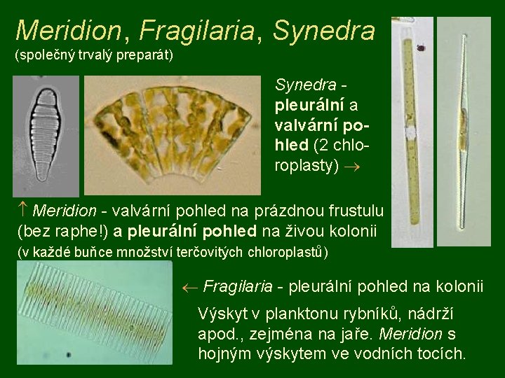 Meridion, Fragilaria, Synedra (společný trvalý preparát) Synedra pleurální a valvární pohled (2 chloroplasty) Meridion