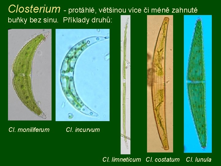 Closterium - protáhlé, většinou více či méně zahnuté buňky bez sinu. Příklady druhů: Cl.