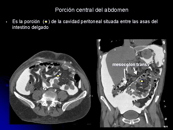 Porción central del abdomen • Es la porción ( ) de la cavidad peritoneal