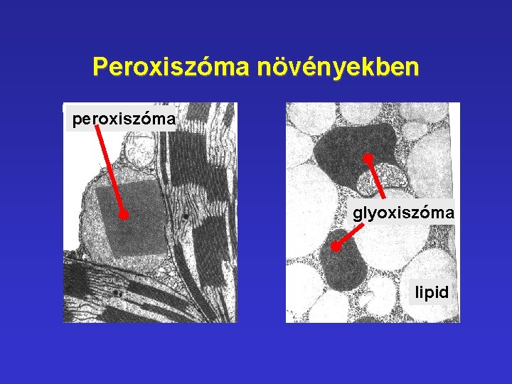 Peroxiszóma növényekben peroxiszóma glyoxiszóma lipid Peroxiszóma növényekben peroxiszóma glyoxiszóma lipid