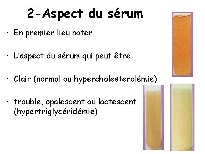 2 -Aspect du sérum • En premier lieu noter • L’aspect du sérum qui