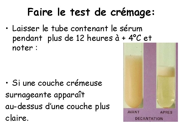 Faire le test de crémage: • Laisser le tube contenant le sérum pendant plus