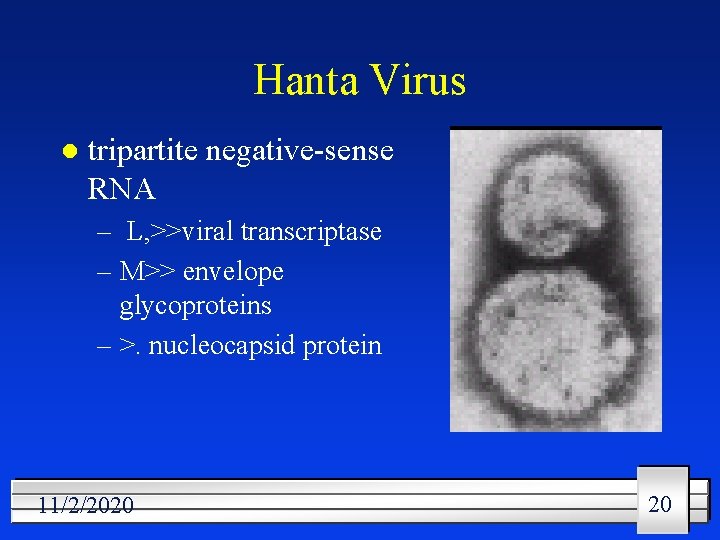 Hanta Virus l tripartite negative-sense RNA – L, >>viral transcriptase – M>> envelope glycoproteins