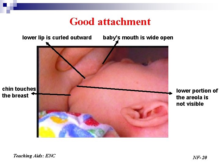 Good attachment lower lip is curled outward chin touches the breast Teaching Aids: ENC