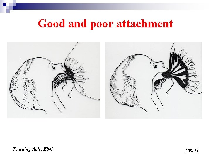 Good and poor attachment Teaching Aids: ENC NF- 21 