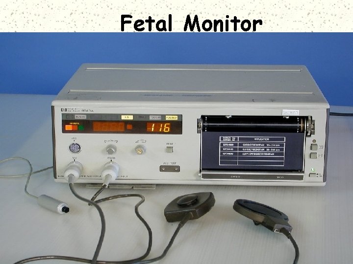 Fetal Monitor 