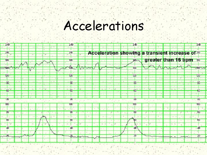 Accelerations 