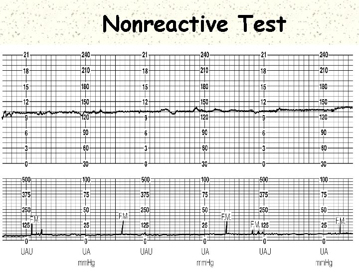 Nonreactive Test 