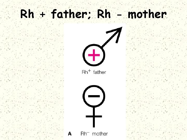Rh + father; Rh - mother 