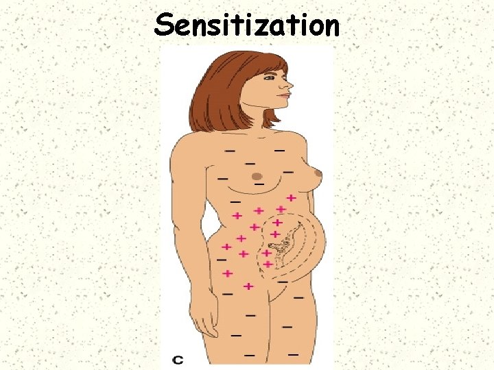 Sensitization 