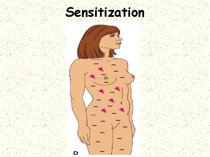 Sensitization 