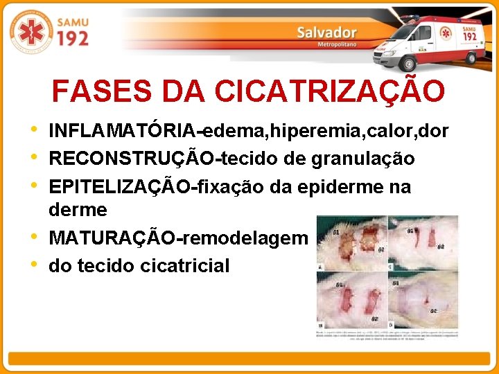 FASES DA CICATRIZAÇÃO • INFLAMATÓRIA-edema, hiperemia, calor, dor • RECONSTRUÇÃO-tecido de granulação • EPITELIZAÇÃO-fixação