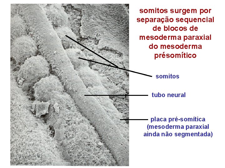 somitos surgem por separação sequencial de blocos de mesoderma paraxial do mesoderma présomítico somitos