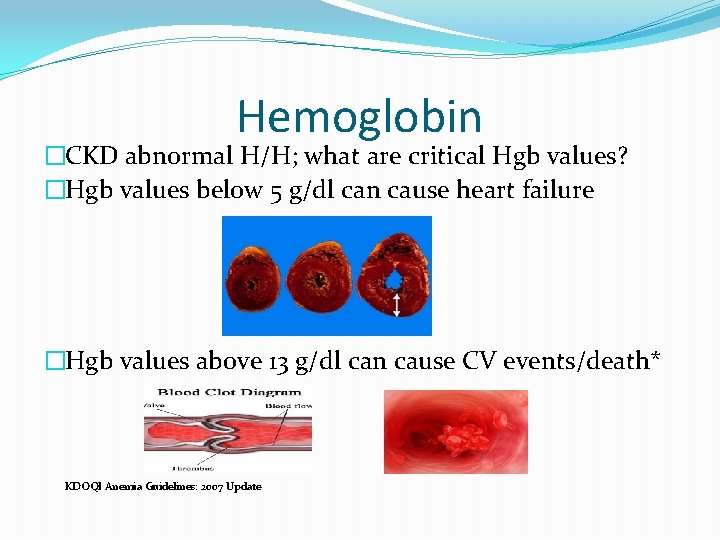 Hemoglobin �CKD abnormal H/H; what are critical Hgb values? �Hgb values below 5 g/dl Hemoglobin �CKD abnormal H/H; what are critical Hgb values? �Hgb values below 5 g/dl