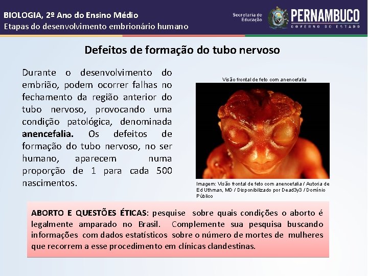 BIOLOGIA, 2º Ano do Ensino Médio Etapas do desenvolvimento embrionário humano Defeitos de formação