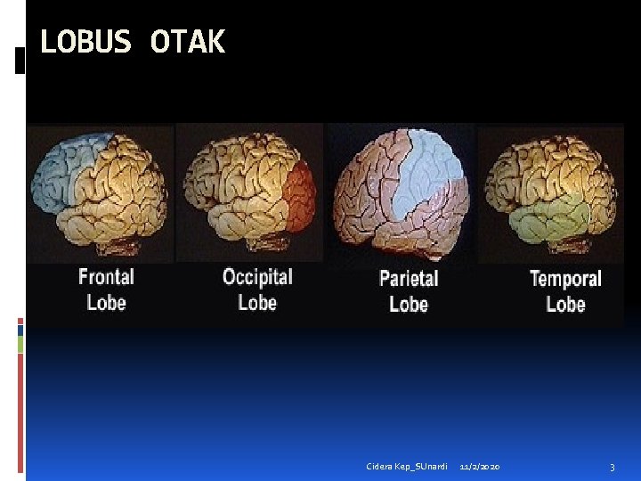 LOBUS OTAK Cidera Kep_SUnardi 11/2/2020 3 