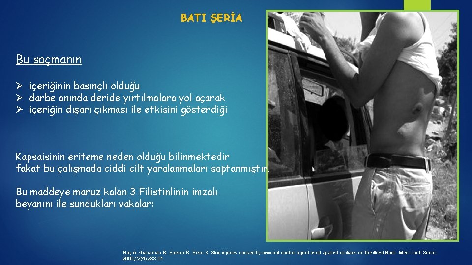 BATI ŞERİA Bu saçmanın Ø içeriğinin basınçlı olduğu Ø darbe anında deride yırtılmalara yol