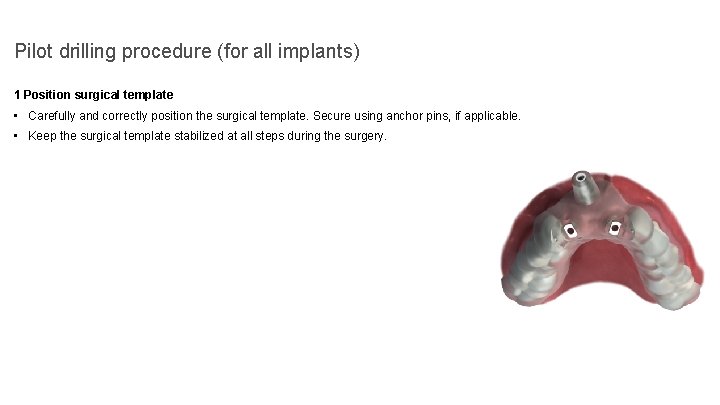 Pilot drilling procedure (for all implants) 1 Position surgical template • Carefully and correctly