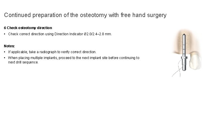 Continued preparation of the osteotomy with free hand surgery 6 Check osteotomy direction •