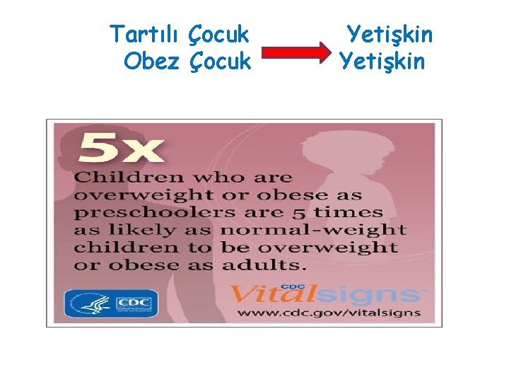 FTartılı Çocuk Obez Çocuk Yetişkin 