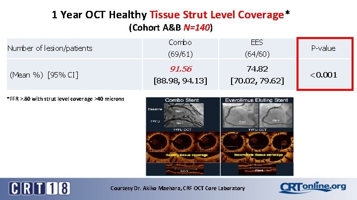 1 Year OCT Healthy Tissue Strut Level Coverage* (Cohort A&B N=140) Number of lesion/patients