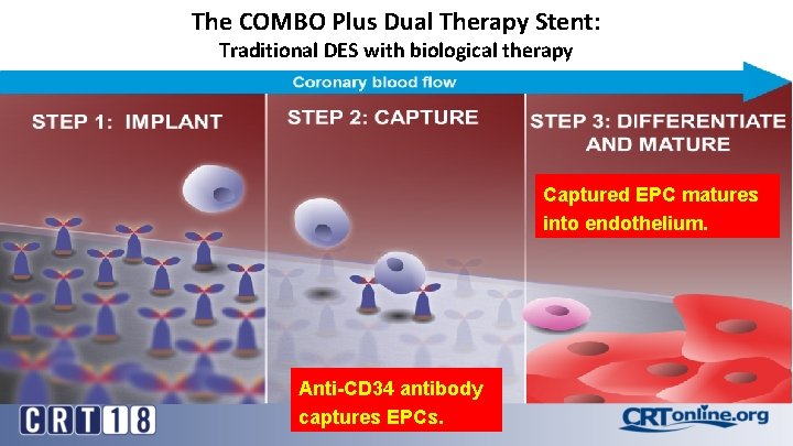 The COMBO Plus Dual Therapy Stent: Traditional DES with biological therapy Captured EPC matures