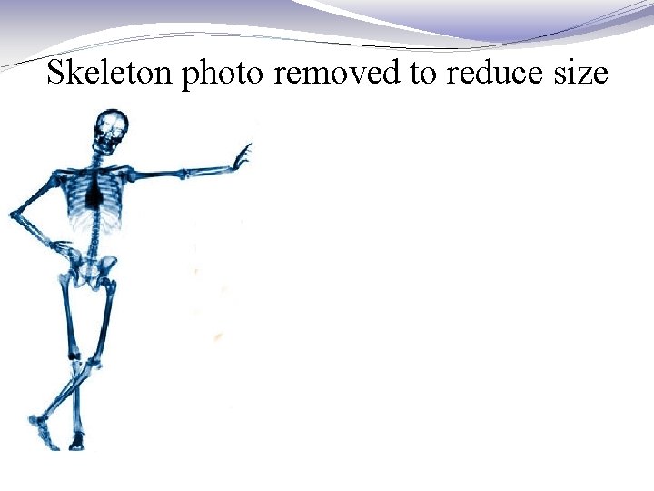 Skeleton photo removed to reduce size 