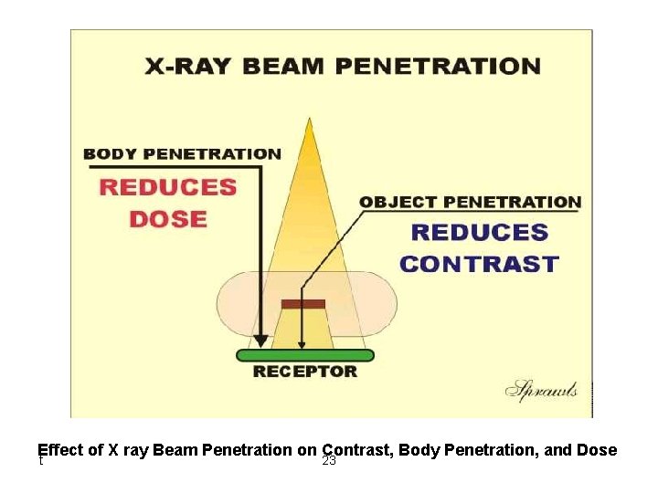 Effect of X ray Beam Penetration on Contrast, Body Penetration, and Dose t 23