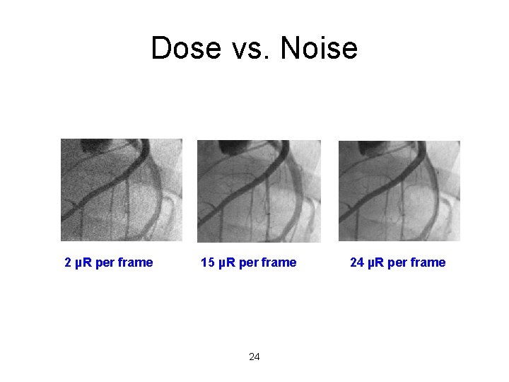 Dose vs. Noise 2 µR per frame 15 µR per frame 24 24 µR