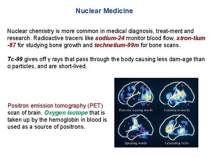 Nuclear Medicine Nuclear chemistry is more common in medical diagnosis, treat ment, and research.