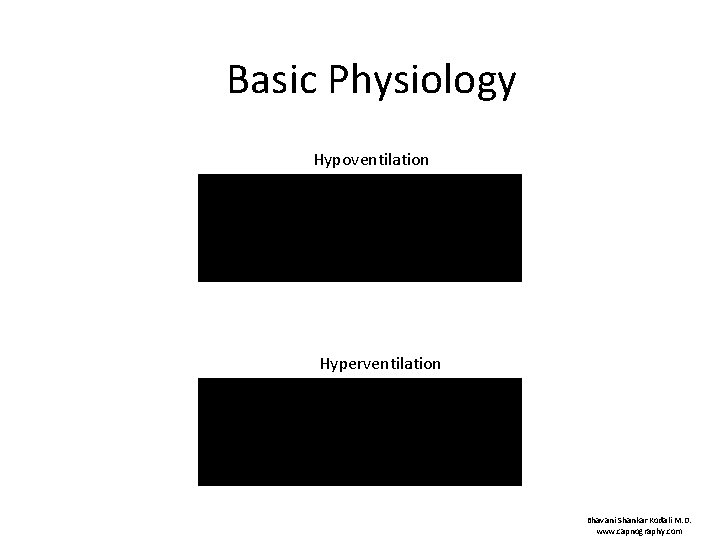 Basic Physiology Hypoventilation Hyperventilation Bhavani Shankar Kodali M. D. www. capnography. com 