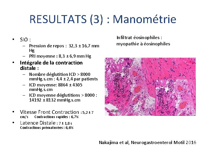 RESULTATS (3) : Manométrie • SIO : – Pression de repos : 32, 3