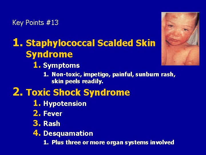 Key Points #13 1. Staphylococcal Scalded Skin Syndrome 1. Symptoms 1. Non-toxic, impetigo, painful,