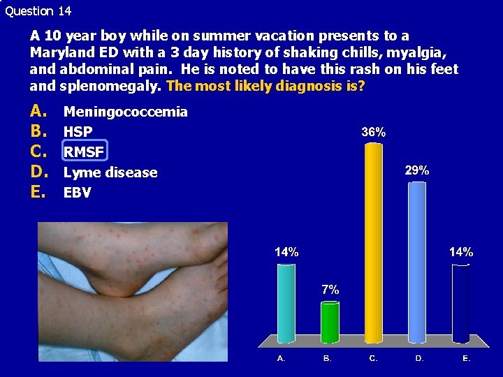 Question 14 A 10 year boy while on summer vacation presents to a Maryland