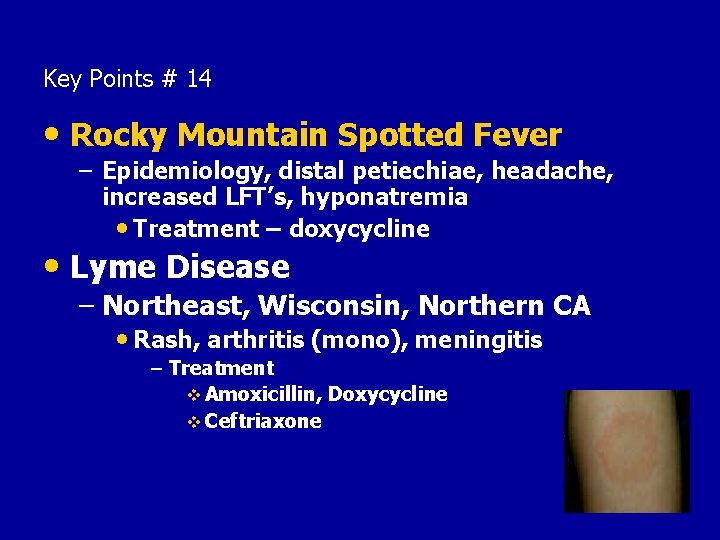 Key Points # 14 • Rocky Mountain Spotted Fever – Epidemiology, distal petiechiae, headache,