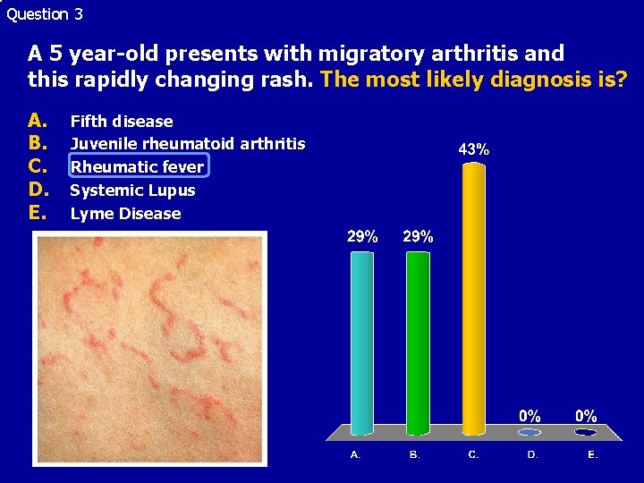Question 3 A 5 year-old presents with migratory arthritis and this rapidly changing rash.