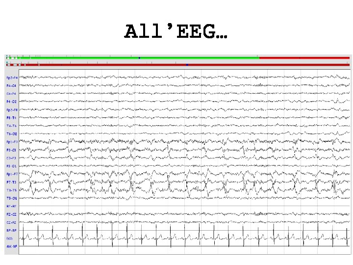 All’EEG… 