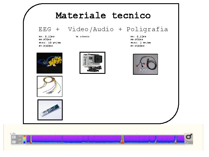 Materiale tecnico EEG + PA: 0, 53 Hz PB: ≥ 70 Hz Sens: 50