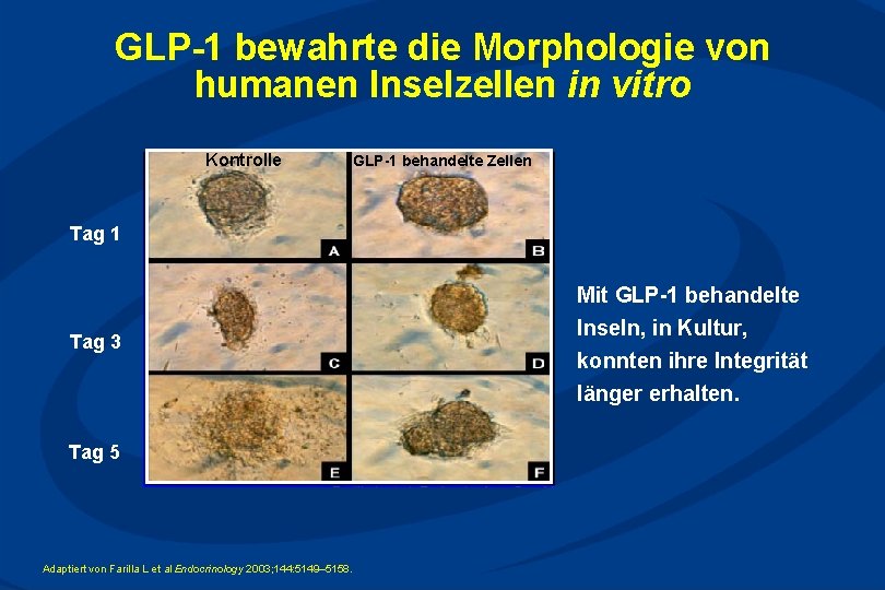 GLP-1 bewahrte die Morphologie von humanen Inselzellen in vitro Kontrolle GLP-1 behandelte Zellen Tag