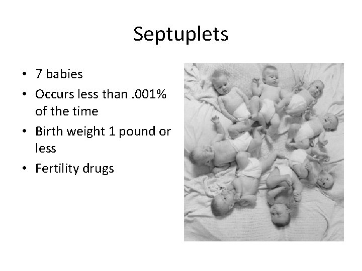 Septuplets • 7 babies • Occurs less than. 001% of the time • Birth