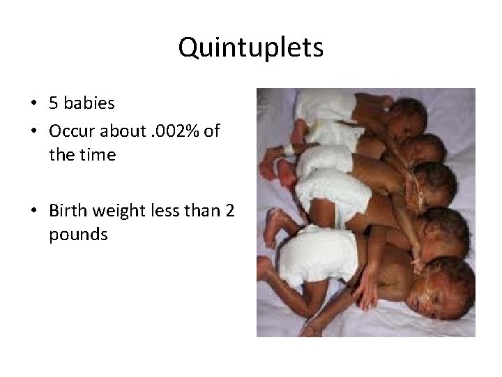 Quintuplets • 5 babies • Occur about. 002% of the time • Birth weight