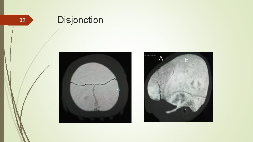 32 Disjonction A B 32 Disjonction A B