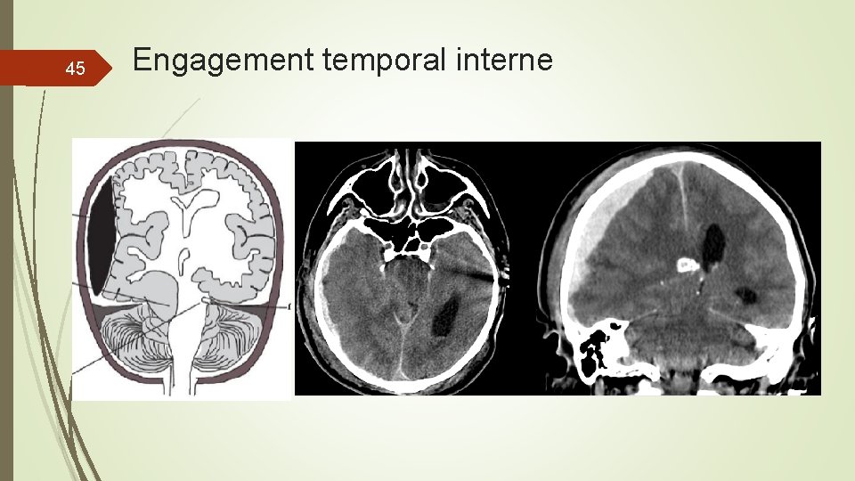 45 Engagement temporal interne 